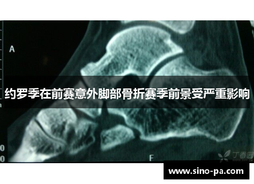 约罗季在前赛意外脚部骨折赛季前景受严重影响